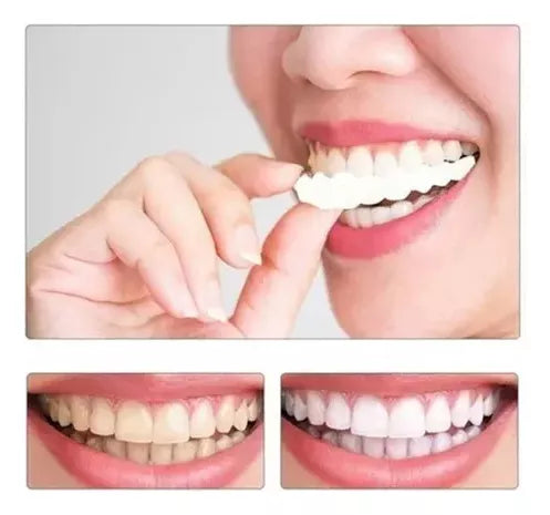 Radiant Smile with OnSmile